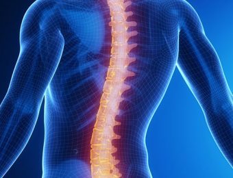 SCOLIOSIS-SQUARE.jpg
